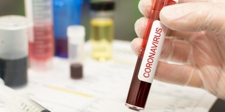 Taxa de positividade da Covid aumenta em 5 regiões de saúde do Ceará