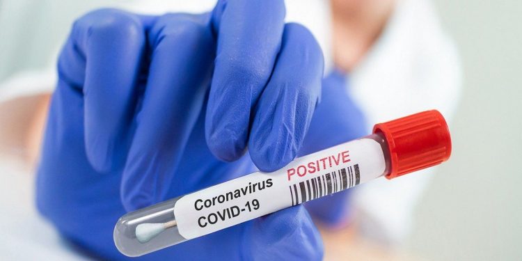 Ceará tem 273.743 casos e 9.344 mortes confirmadas pelo novo coronavírus