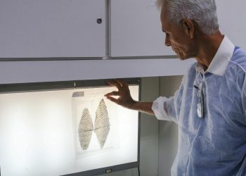 Curativo biológico criado no Ceará é usado em seres humanos para acelerar recuperação de queimaduras (Foto: Saulo Roberto)