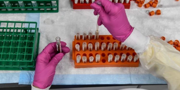 Brasil registra mais de 35 mil casos de Covid-19 em 24h; média móvel segue alta