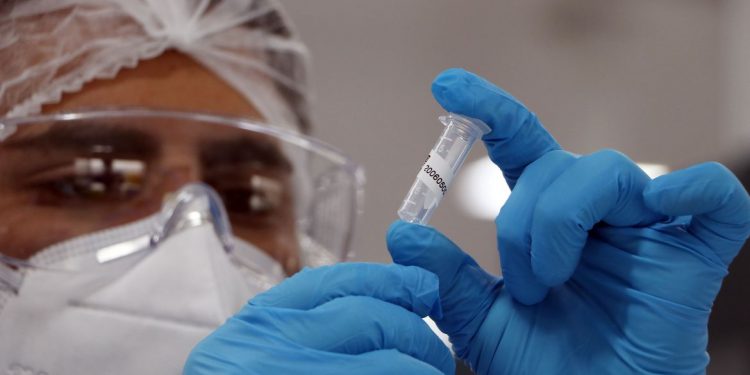 Covid-19: Brasil registra mais 10,5 mil casos confirmados em 24h