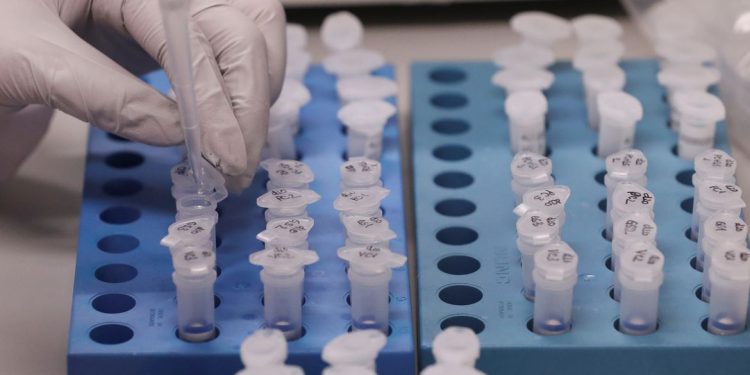 Covid-19: Brasil tem 162 mil mortes e 5,67 milhões de casos acumulados