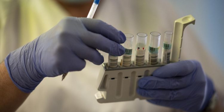 Após dois dias em alta, média móvel de óbitos por Covid-19 cai para 363