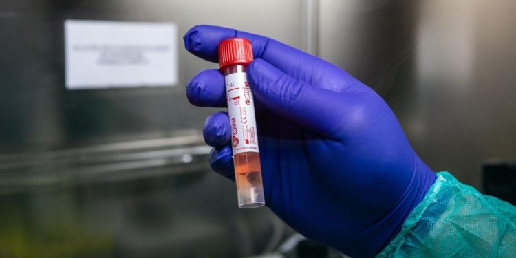 Ceará realiza mais de um milhão de testes para Covid-19 em oito meses de pandemia