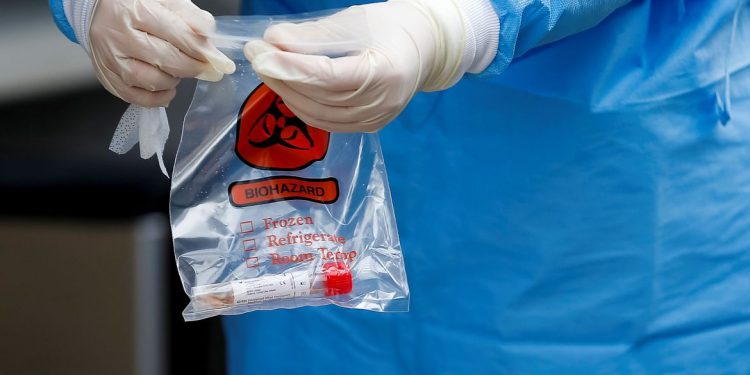 Ceará registra mais de 278 mil casos confirmados de Covid-19 e tem 9.407 óbitos pela doença