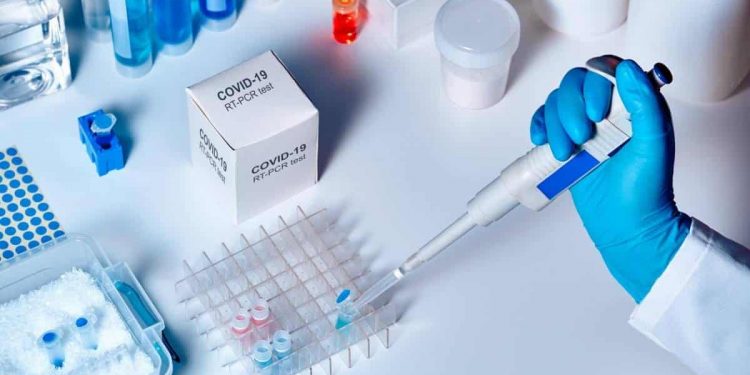 Brasil tem 6,8 milhões de testes de Covid-19 prestes a vencer em depósito