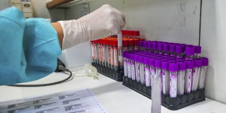 MP pede investigação sobre testes para Covid-19 encalhados