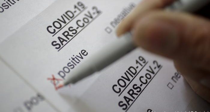 Ceará registra 289.550 casos de Covid-19; mortes estão em 9.473