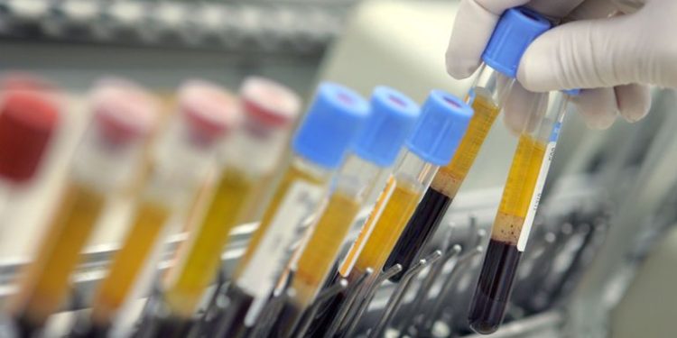 Ceará ultrapassa a marca de 300 mil casos confirmados de Covid-19