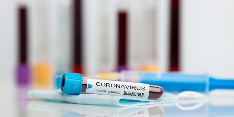 Ceará acumula mais de 288 mil diagnósticos positivos de Covid-19; já são 9.466 óbitos registrados