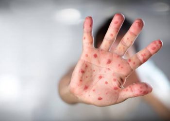 (Foto: RomoloTavani/iStock)