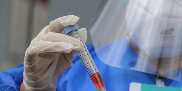 Casos de Covid-19 aumentam 146,6% em duas semanas na região do Cariri, aponta boletim da Sesa