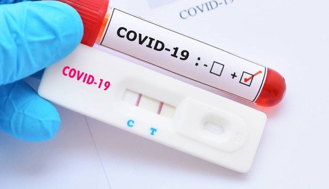 Ceará registra mais de 316 mil casos de Covid-19 desde o início da pandemia; óbitos chegam a 9.802