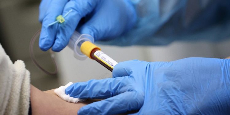 Brasil chega a 191.570 mortes por Covid-19 nesta segunda (28)