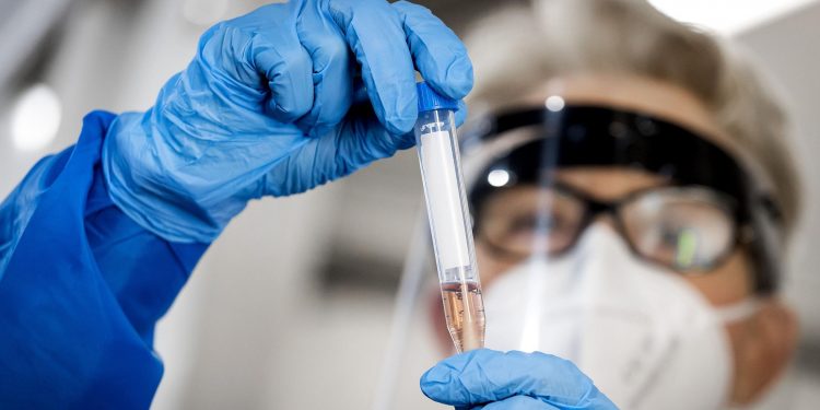 Vacina contra Covid: Ceará prepara planos distintos para vacinação com diferentes laboratórios