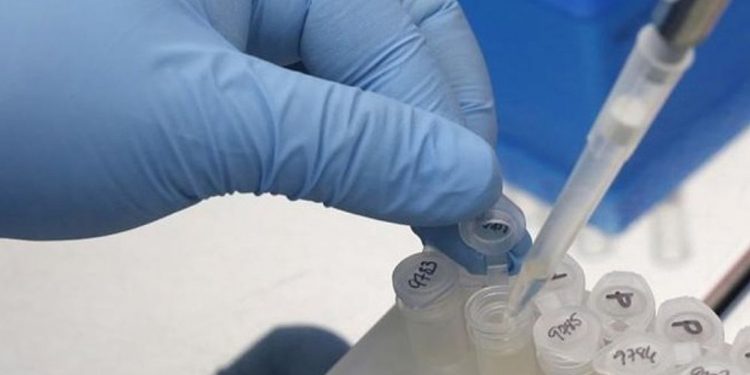 Brasil registra 527 novas mortes por Covid; total ultrapassa 187 mil