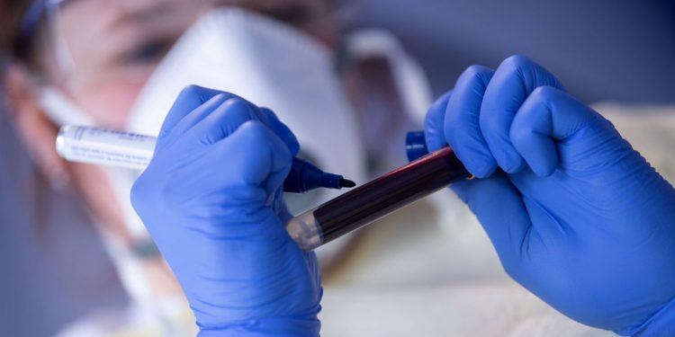 Ceará registra mais de 319 mil casos de Covid-19 e chega a 9.857 óbitos pela doença