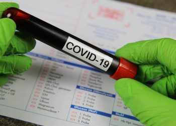 Brasil registra mais de 300 mortes por Covid-19 nas últimas 24 horas