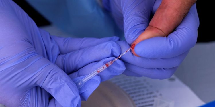 Ceará chega a 358.404 casos confirmados de Covid-19 e 10.261 mortes