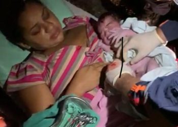 Gestantes precisou fazer o parto às margens da rodovia BR-020 (Foto: Divulgação)