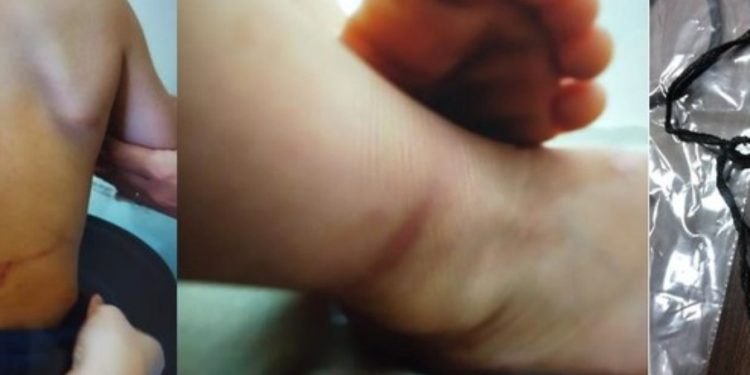 Casal é preso suspeito de torturar os filhos; bebê foi resgatado