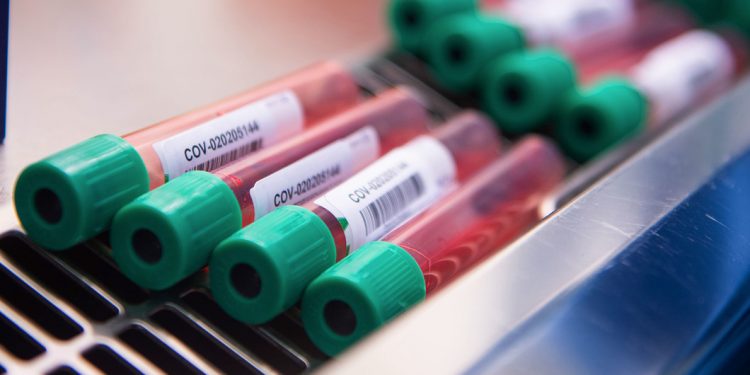 Ceará passa dos 394 mil casos de Covid-19 e registra 10.834 óbitos pela doença