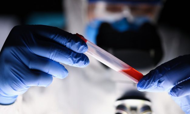 Brasil completa 33 dias com média móvel de óbitos por Covid-19 acima de 1.000