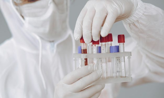 70% dos casos de nova cepa do coronavírus no Ceará são de variantes não detectadas na primeira onda