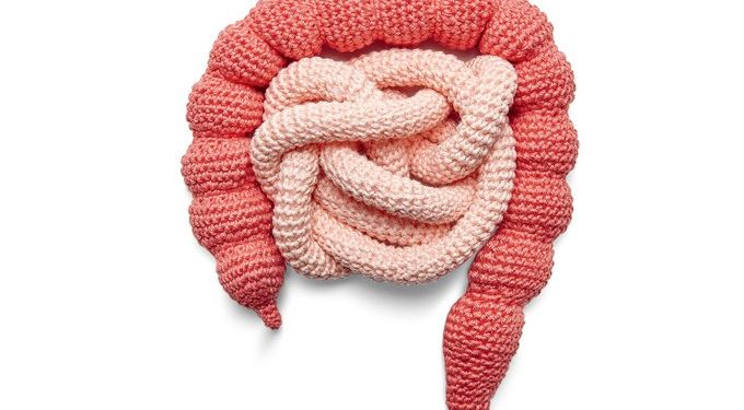 Câncer de intestino pode ser evitado com mudança de hábitos