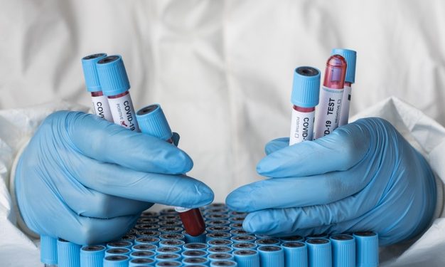 Covid-19: Brasil registra mais de 2 mil mortes nas últimas 24 horas