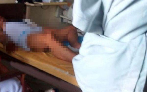 Homem toma uma caixa de Viagra de uma vez e fica com o ‘membro’ ereto por uma semana