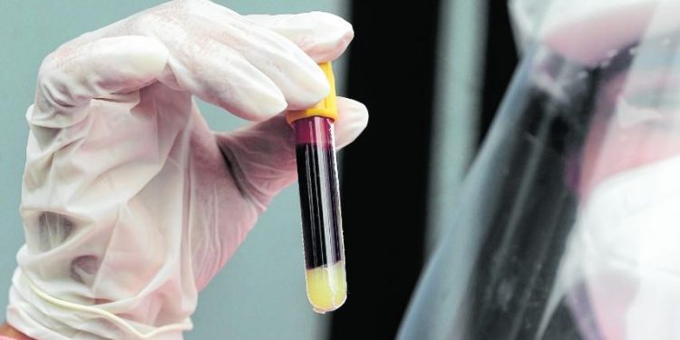 Covid-19: Brasil continua com média móvel de mortes em queda; veja números