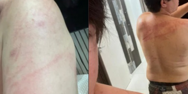 DJ Ivis aparece ferido em fotos e Pamella Holanda diz: “Nunca o vi assim”