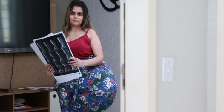 Mulher com tumor de cerca de 35 kg usa redes sociais para conscientizar sobre doença rara: ‘Coragem de expor para ajudar outras pessoas’