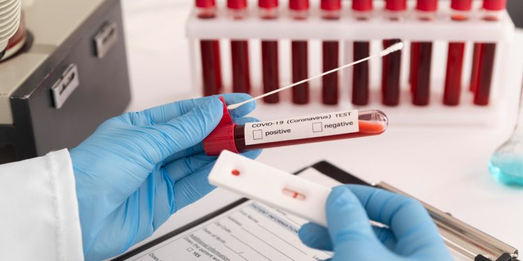 Em 24h, Brasil registra 98 mortes por Covid-19