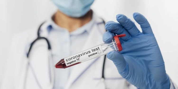 Brasil tem queda recorde de casos de Covid em grandes cidades desde início da pandemia