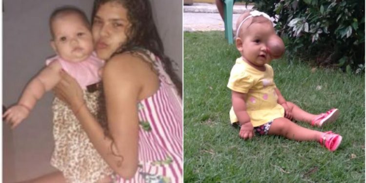 Criança com tumor raro recebe doação de medicamento de R$ 40 mil: ‘Choramos tanto’