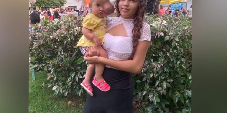 Criança com tumor no rosto precisa de remédio de R$ 40 mil, e mãe pede ajuda