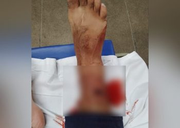 Guarda municipal foi atingido na perna por um tiro durante a abordagem (Foto: Reprodução)