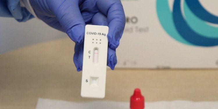 Planos de saúde agora são obrigados a cobrir testes rápidos de Covid-19