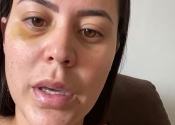 Conforme a vítima, o crime aconteceu no dia 23 de janeiro, em Barbalha (Foto: Reprodução/Instagram)