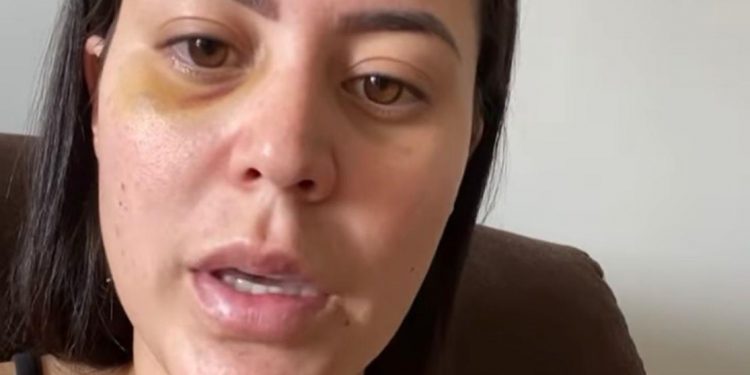 Barbalha: Polícia Civil investiga violência contra mulher que acusou ex-namorado nas redes sociais