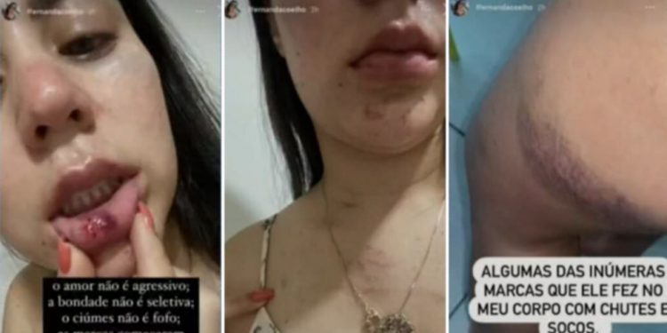 Jovem denuncia ex por agressão em Barbalha, e incentiva outras mulheres: ‘Vocês podem denunciar’