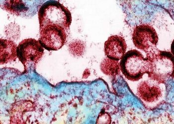 Amostra de células humanas infectadas pelo HIV (Imagem: NIAID-NIH)