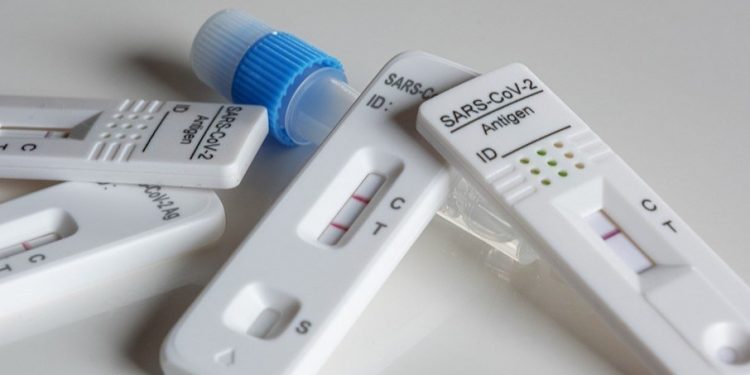 Anvisa aprova o registro do primeiro autoteste para Covid-19