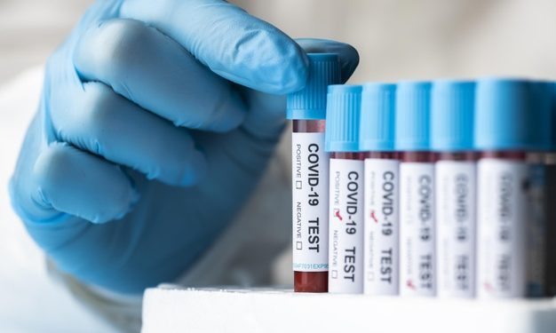 Brasil registra 672 mortes por Covid-19 em 24 horas