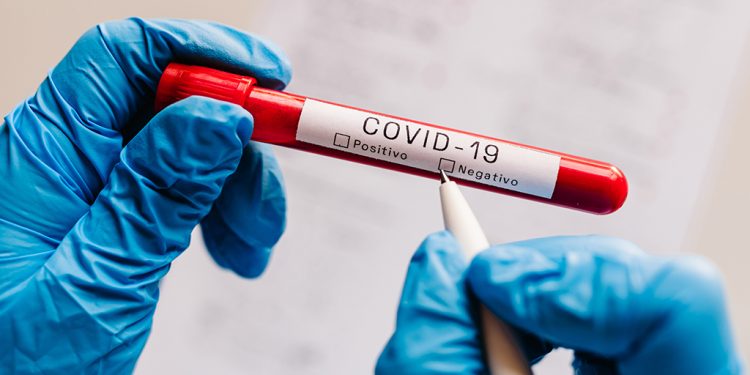 Covid-19: Brasil registra 677 mortes e 69 mil casos nesta sexta-feira (4)