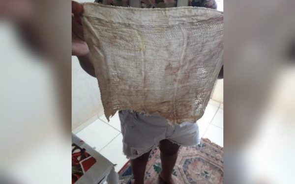 Mulher passa mal e descobre que havia pano dentro do ânus