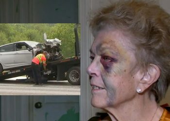 Idosa com olho roxo após roubo e agressão nos EUA (Foto: Reprodução)