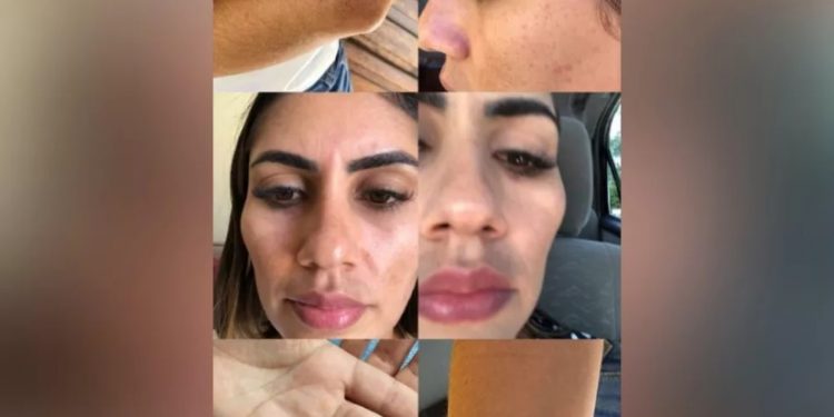 ‘Usava uma das mãos para me enforcar e com a outra dava vários socos’, diz passageira agredida por motorista de app em Juazeiro do Norte